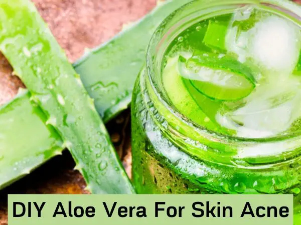 DIY Aloe Vera For Skin Acne scars
